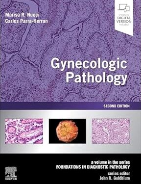 Gynecologic Pathology: A Volume in Foundations in Diagnostic Pathology Series 2nd Edition