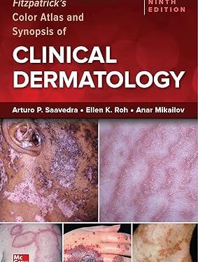 Fitzpatrick's Color Atlas and Synopsis of Clinical Dermatology, Ninth Edition 9th Edition