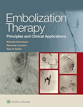 Embolization Therapy: Principles and Clinical Applications First Edition, Kindle Edition