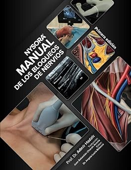 NYSORA Manual de los Bloqueos de Nervios: Primera Edición (Spanish Edition) Paperback – Large Print, August 16, 2023