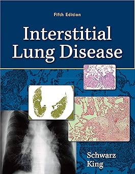 Interstitial Lung Disease Kindle Edition