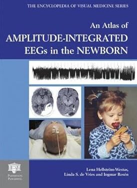 An Atlas of Amplitude-Integrated EEGs in the Newborn, Second Edition, with DVD (Encyclopedia of Visual Medicine Series) 1st Edition