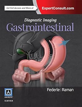 Diagnostic Imaging: Gastrointestinal E-Book 3rd Edition, Kindle Edition