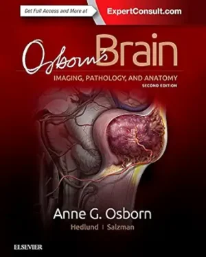 Osborn's Brain 2nd Edition