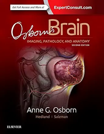 Osborn's Brain 2nd Edition