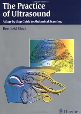The Practice of Ultrasound A Step-by-Step Guide to Abdominal Scanning
