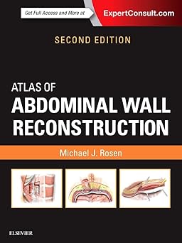 Atlas of Abdominal Wall Reconstruction: Expert Consult - Online and Print 2nd Edition