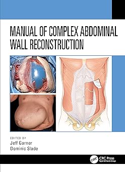 Manual of Complex Abdominal Wall Reconstruction 1st Edition, Kindle Edition