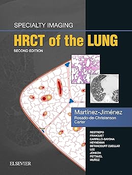 Specialty Imaging: HRCT of the Lung E-Book 2nd Edition, Kindle Edition
