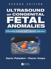 Ultrasound of Congenital Fetal Anomalies: Differential Diagnosis and Prognostic Indicators, Second Edition 2nd Edition
