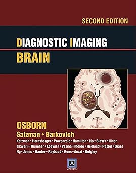 Diagnostic Imaging Brain 2nd Edition