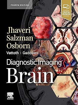 Diagnostic Imaging: Brain E-Book 4th Edition
