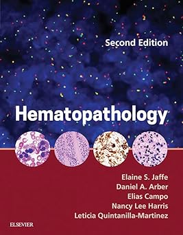 Hematopathology E-Book 2nd Edition, Kindle Edition