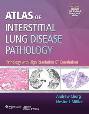 Atlas of Interstitial Lung Disease Pathology: Pathology with High Resolution CT Correlations First Edition