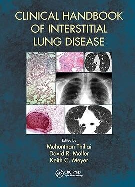 Clinical Handbook of Interstitial Lung Disease 1st Edition