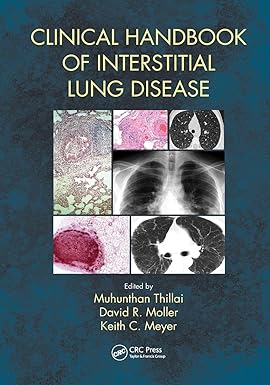 Clinical Handbook of Interstitial Lung Disease 1st Edition